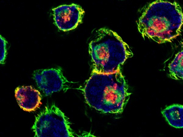 이 이미지는 암세포 내에 들어간 RNA 나노입자(빨간색)를 보여준다. 이 실험에서는 나노입자가 정상세포에는 반응하지 않고 암세포(녹색 : 세포 골격, 적색 : 형광성 pRNA 나노 입자, 청색 : 핵)만을 대상으로하는 것으로 밝혀졌다. (Nature Nanotechnology 2011, 6 : 658; Nano Today 2012, 7 : 245, Nature Protocols 2013, 8 : 1635) 출처 미국립암연구소 