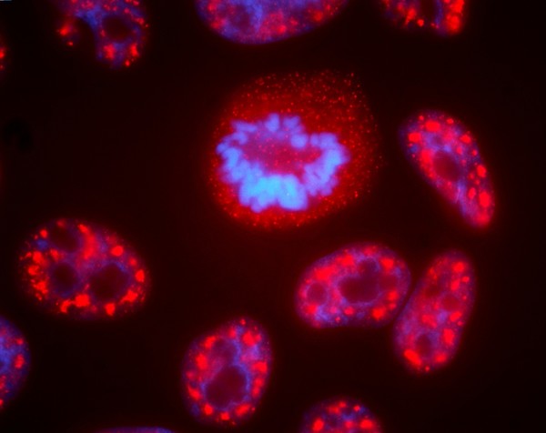 인간 세포핵에는 염색체(파란색) 옆에 있는 RNA 처리 단백질(빨간색)을 포함하는 반점과 같이 세포의 기능에 기여하는 많은 별개의 구획이 포함되어 있다. 이 얼룩은 세포 분열 (중앙 세포) 중에 분해 및 재조립된다. 출처 NCI