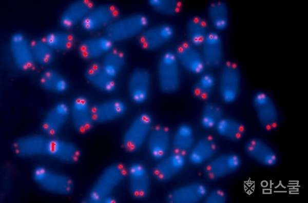 염색체 끝(빨간색)은 텔로미어(telomeres)라는 물질로 염색체가 풀어지지 않도록 보호하는 역할을 한다. 이 이미지는 일부 염색체에 텔로미어 변이로 비정상적인 세포 분열과 암을 유발할 수 있음을 보여준다. 출처 미국립암연구소