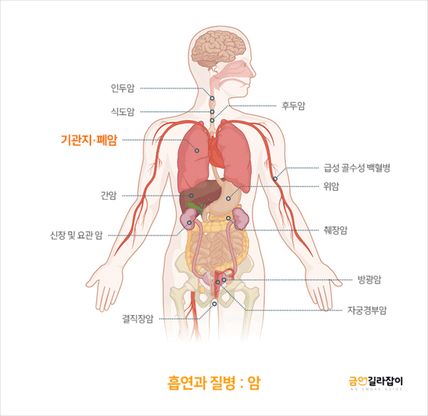 흡연과 관련된 암에는 인두, 식도, 후두, 폐암 및 신장, 방광, 간암 등이 있다. 출처 보건복지부 금연갈라잡이 홈페이지 