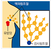 림프절 곽청술 시 흔히 절제하는 액와림프절과 각시림프절. 출처 삼성서울병원 암교육센터