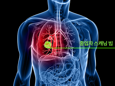 중입자스캐닝빔.  출처 서울대학교병원기장암센터