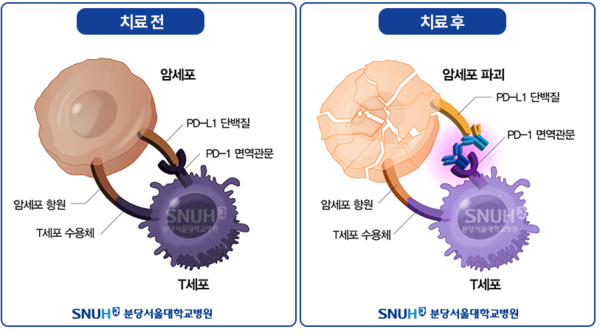 면역관문억제제 효과. 출처 분당서울대학교병원