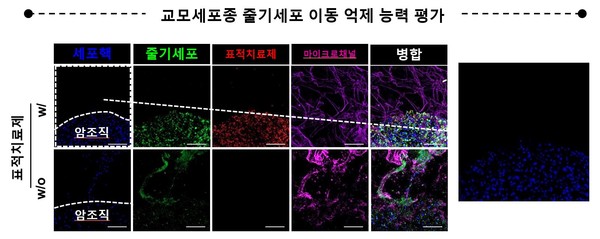 연구팀 개발 치료제를 투여했을 때 암세포 이동(가장 왼쪽 위)이 안 했을 때(가장 왼쪽 아래)보다 적어 치료 효과가 좋았다. 출처 세브란스병원