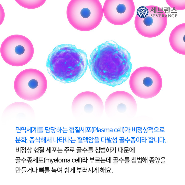 다발골수종은 우리 몸에서 면역항체를 만드는 형질세포가 혈액암으로 변하여 주로 골수에서 증식하는 질환이다. 출처 세브란스