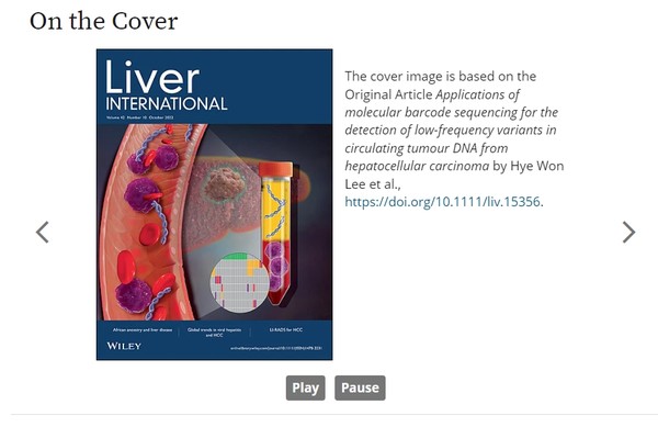  '리버 인터내셔널'(Liver international) 최신호에 표지논문으로 발표된 연구. 출처 Liver international