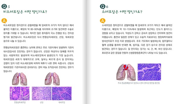 출처 대한폐암학회