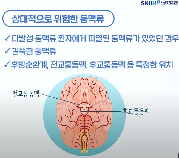 위험한 뇌동맥류. 출처 서울대병원