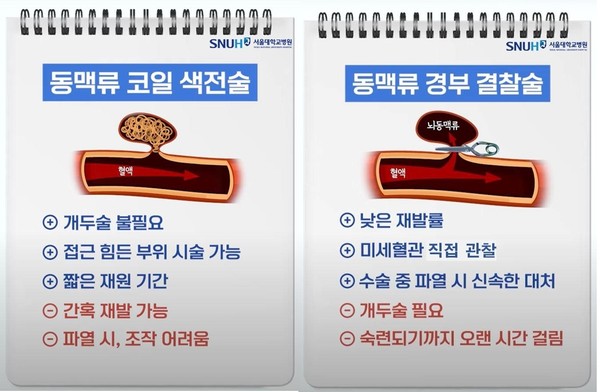 뇌동맥류 치료법. 출처 서울대병원