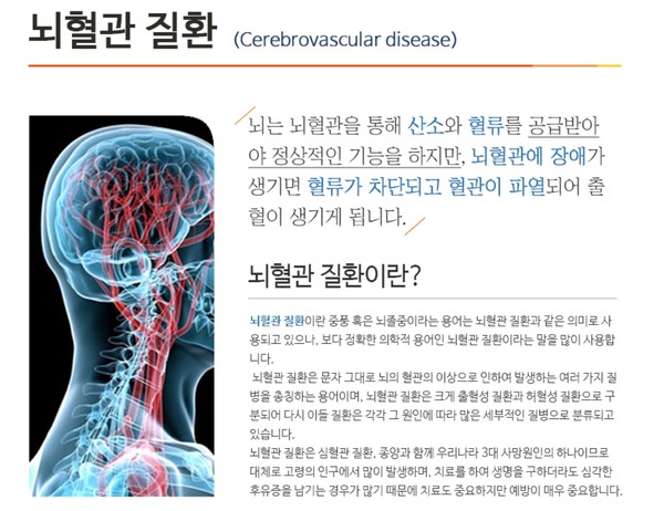 뇌혈관 질환. 출처 수병원