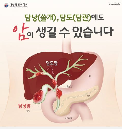 출처 대한췌장남도학회