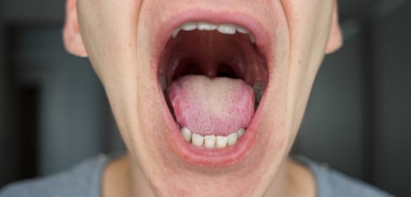 입이 정상적으로 어떻게 생겼는지 알고 있으면 관련된 변화를 발견하는 데 도움이 될 수 있다. 출처 엠디앤더슨 암센터