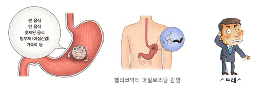 위암 원인. 출처 대한상부위상관, 헬리코박터 학회