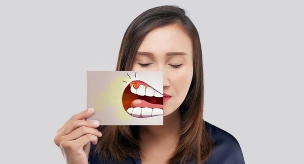 잇몸 암, 치은암은 보통 잇몸 표면에서 바깥쪽으로 자란다. 출처 엠디앤더슨 암센터 