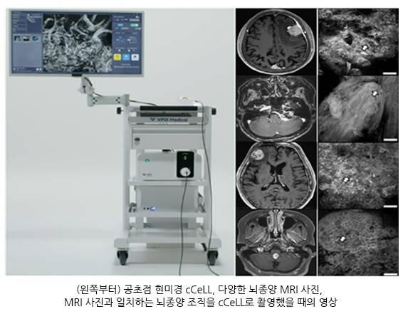 출처 고대안암병원