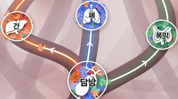 담낭에 다양한 클론들이 섞여 있다가, 주황색 클론이 이긴 암세포는 간으로, 파란색 클론이 이긴 암세포는 폐로, 초록색 클론이 이긴 암세포는 복막으로 간다. 출처 분당서울대병원