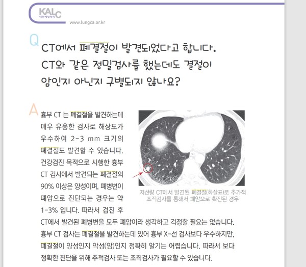 출처 대한폐암학회