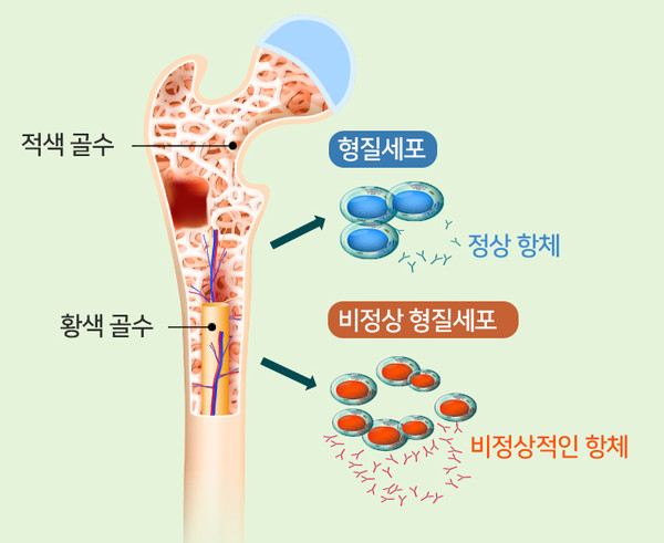 출처 가천대길병원