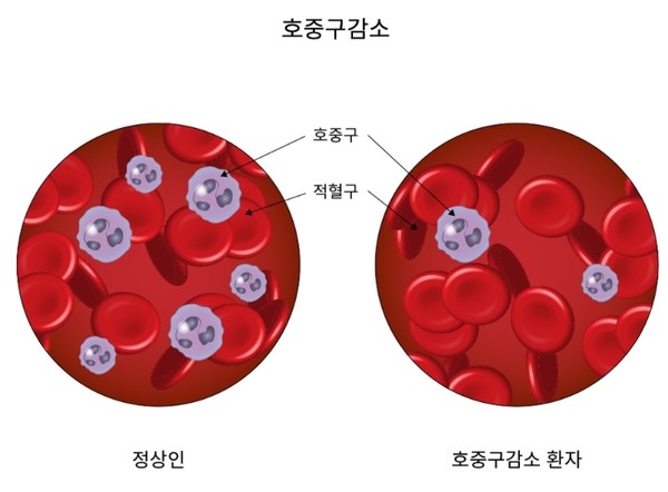호중구감소. 출처 질병관리청