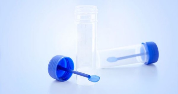 대장내시경 검사는 대장암 검진을 위한 가장 믿을 수 있는 검사이지만, 다른 검사도 가능하다. 출처 : 엠디앤더슨 암센터 
