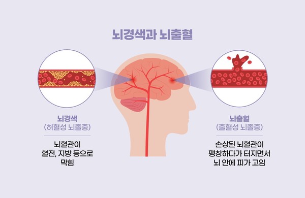 출처 원주연세의료원