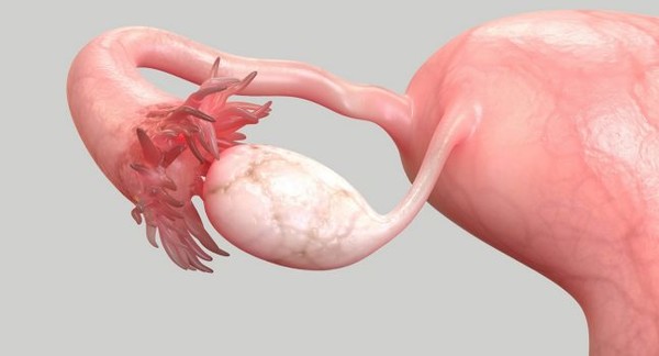 난소암 발병 위험이 높은 사람은 단독 수술을 받는 것이 좋다. 출처 : 엠디앤더슨 암센터 