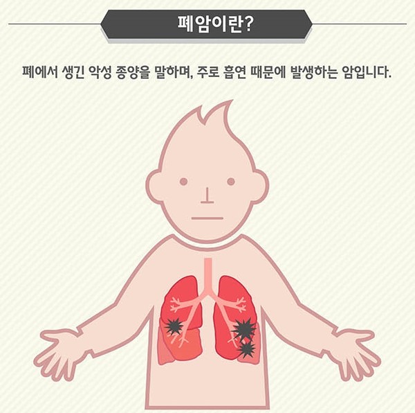 출처 국가암정보센터