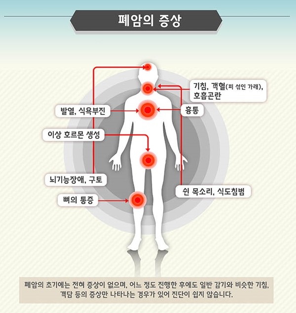 출처 국가암정보센터