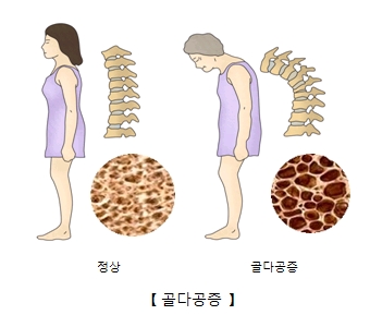 출처 서울아산병원