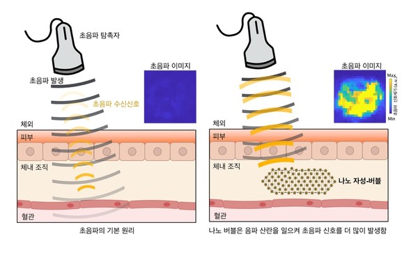 나노 자성-버블 초음파 영상의 원리초음파의 기본 원리는 음파가 조직을 통과하면서 여러 조직 층을 만나며 반사/산란/굴절되는 신호를 읽는 것으로, 이를 통해 초음파 영상이 생성된다. 특히 음파는 매질 간의 음파 저항차이가 크게 되면 음파의 산란이 더 크게 발생하여 초음파 신호가 더 많이 발생된다. 출처 IBS