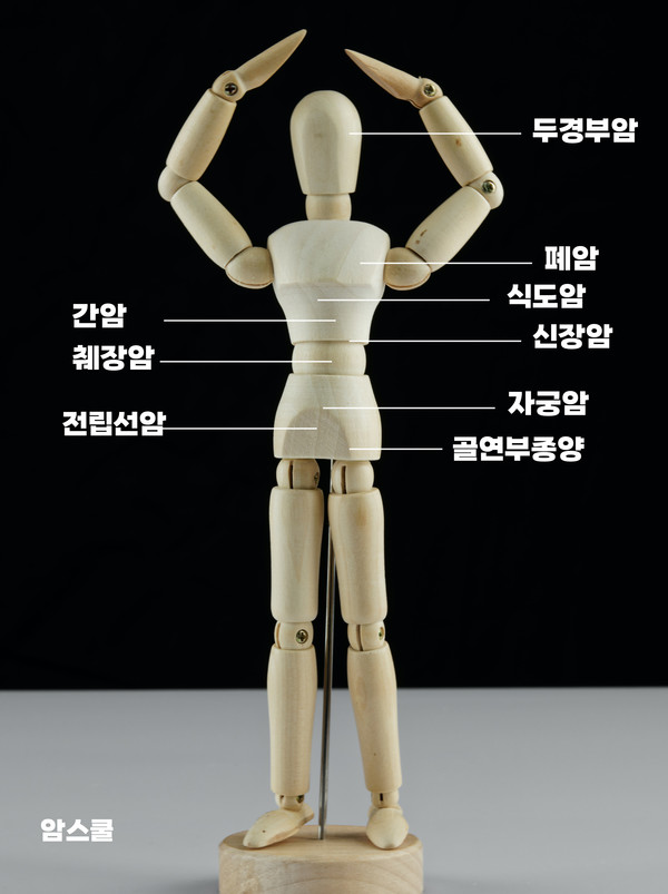 일본에서 중입자치료가 진행되고 있는 암은 두경부암, 식도암, 폐암, 간암, 담관암, 췌장암, 신장암, 직장암, 자궁암, 전립선암, 골연부종양 등이다. ⓒ 암스쿨 