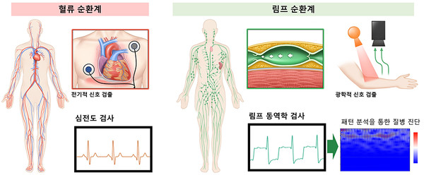 심전도 검사와 림프 동역학 검사 비교. 출처 서울아산병원