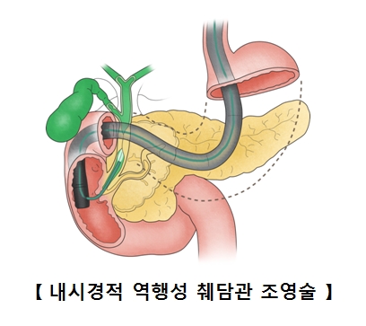 출처 서울아산병원