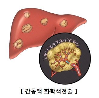 출처 서울아산병원