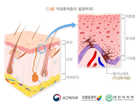 출처 국가암정보센터
