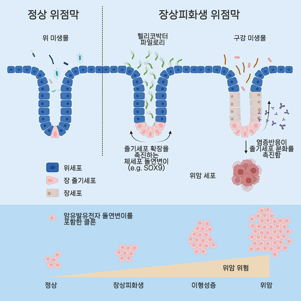 장상피회생 위암 진행 관여하는 유전자 변이 규명. 출처 서울대학교병원