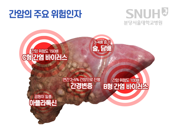 출처 분당서울대병원