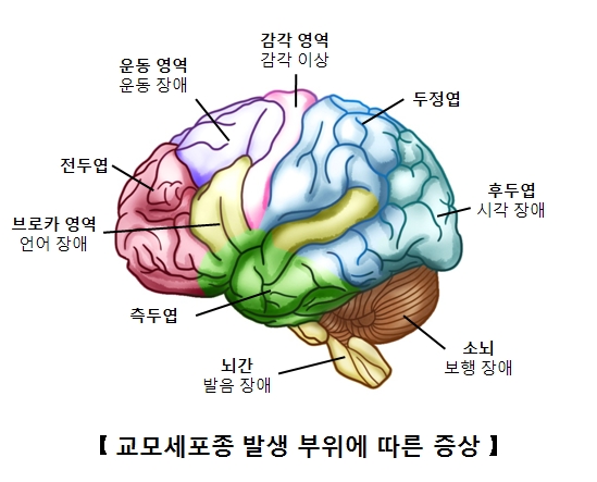 출처 서울아산병원