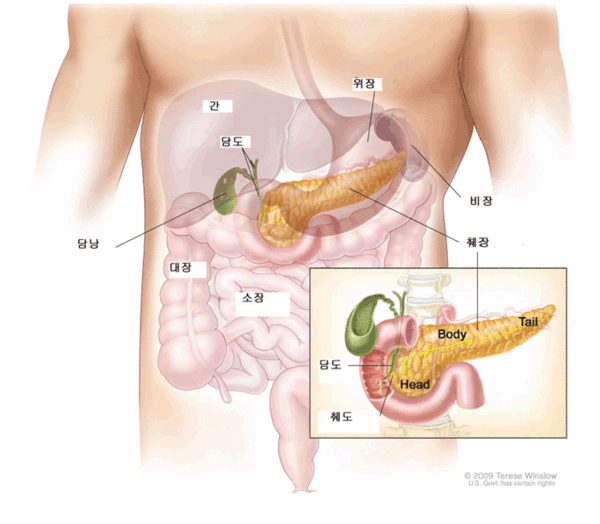 췌장절제술을 받은 후 당뇨가 발생한 환자는 허혈성심장질환 위험이 높은 것으로 밝혀졌다. 출처 대한종양외과학회