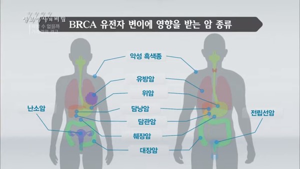 난소암·유방암 등의 발병 원인으로 알려진 BRCA 유전자 변이가 망막에 생기는 악성 종양인 망막모세포종을 유발하는 새로운 인자라는 연구 결과가 나왔다.. 출처 KBS생로병사 화면 갈무리