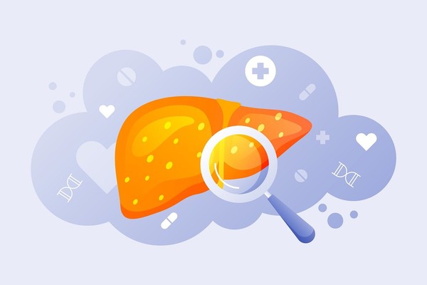 비알코올성 지방간이 있는 여성은 50세 미만에서 발생하는 젊은 연령 난소암 발병 위험이 큰 것으로 나타났다. 출처 픽사베이