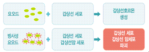 방사성 요오드 치료와 암 발생 위험과 관계없다는 연구 결과가 나왔다. 출처 국가암정보센터