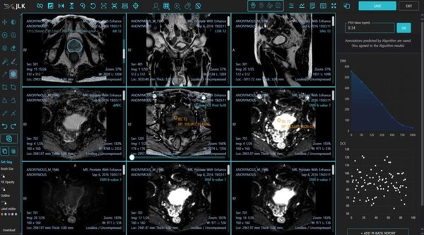 국내 의료 AI 1호 상장기업인 제이엘케이는 자사가 개발한 AI 전립선암 진단 솔루션 ‘MEDIHUB Prostate’가 미국 식품의약국(FDA)승인을 획득했다고 24일 발표했다. 출처 제이엘케이