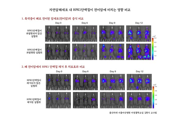 자연살해세포 내 HPK1단백질이 전이암에 미치는 영향 비교. 김헌식·성창옥 교수팀의 연구 결과, (1)HPK1이 과발현 됐을 때 폐를 비롯하여 다양한 장기로 전이암이 빠르게 진행했으며, (2)반대로 폐전이암에서 HPK1을 제거하면 면역관문억제제의 치료효과가 더욱 커지는 것으로 나타났다. 출처 서울아산병원