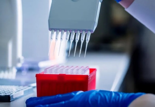 모낭 DNA 추출, 혈액종양 생식세포 검사 향상. 출처 : 메이요 클리닉